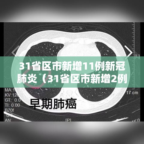 31省区市新增11例新冠肺炎(31省区市新增2例新冠) 31省区市新增11例新冠肺炎(31省区市新增2例新冠)