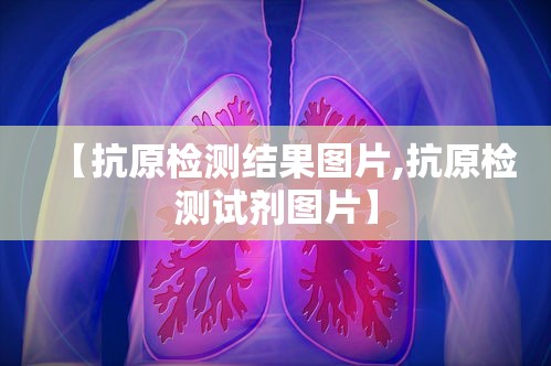 【抗原检测结果图片,抗原检测试剂图片】 【抗原检测结果图片,抗原检测试剂图片】