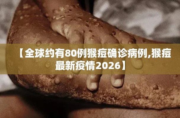 【全球约有80例猴痘确诊病例,猴痘最新疫情2026】 【全球约有80例猴痘确诊病例,猴痘最新疫情2026】